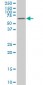 MAK Antibody (monoclonal) (M01)